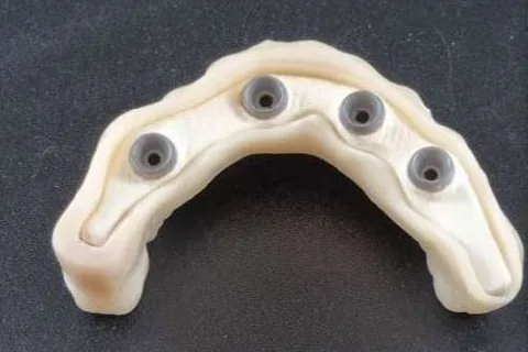 Sottostruttura in fibra con i cilindri per gli impianti
