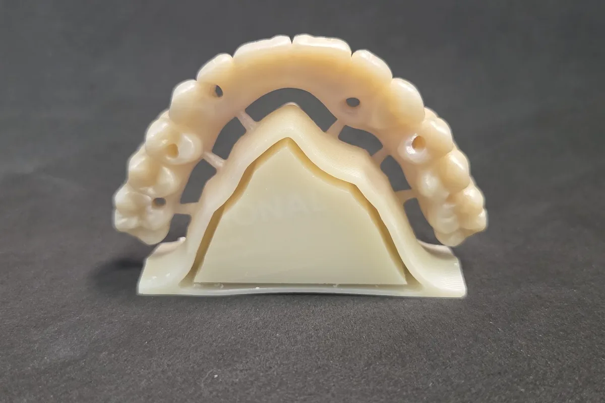 Toronto bridge in zirconia, vista dall'alto