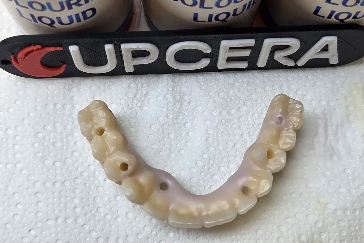 Toronto bridge in zirconia con i liquidi di colorazione Upcera