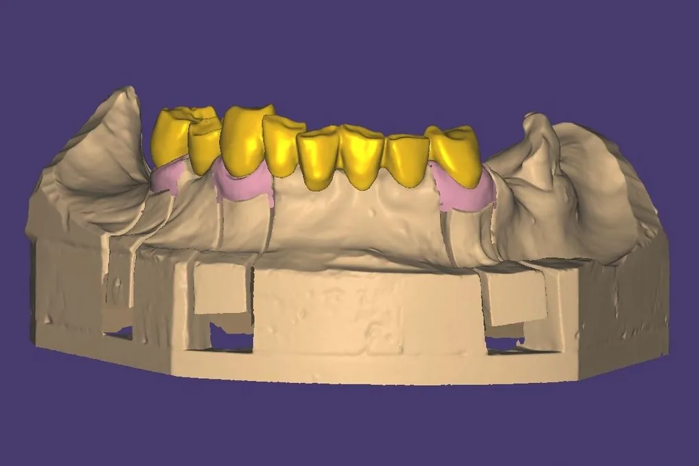 Progetto digitale del manufatto sul modello virtuale