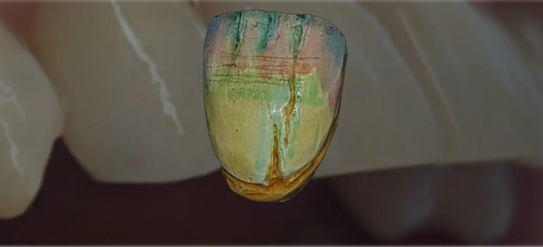 Corona anteriore colorata, in lavorazione